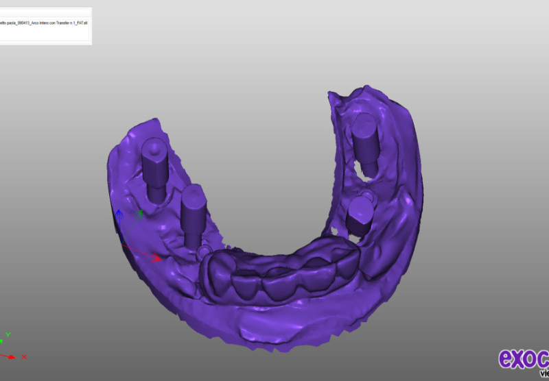 Scansione 3D con modello digitale