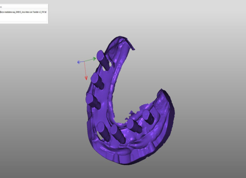 Modello virtuale con scan abutment