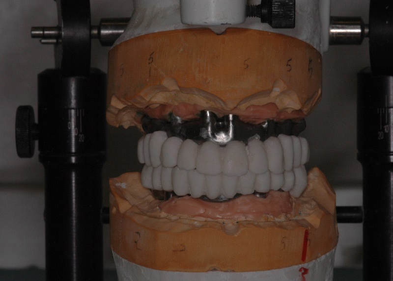 Barre con prototipazione in resina - vista frontale