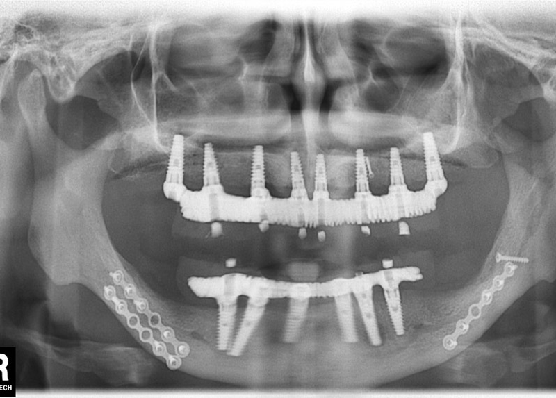 Controllo radiologico